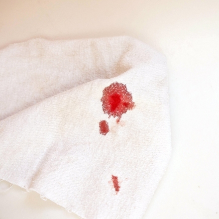 Cómo limpiar manchas de sangre